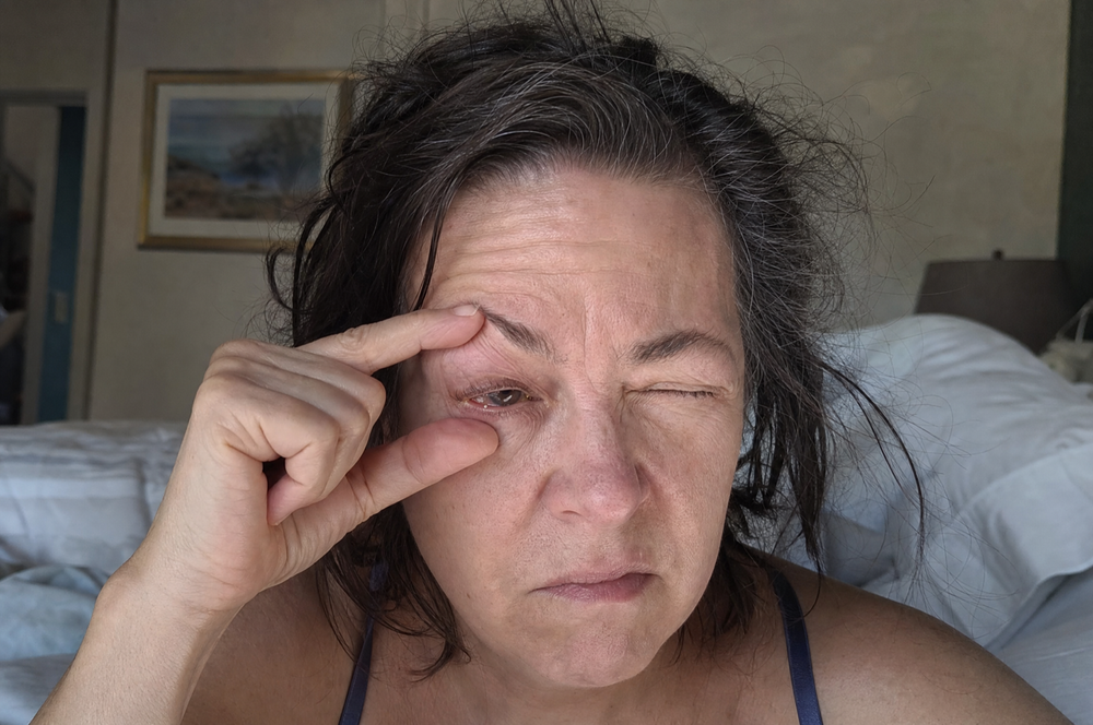 2. You wake up with your eyelids stuck together