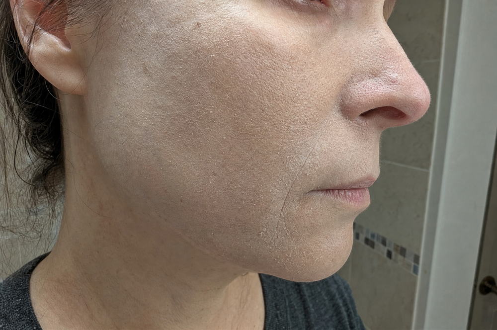 Red Flag #1. Sandpaper Skin No Moisturizer Fixes
